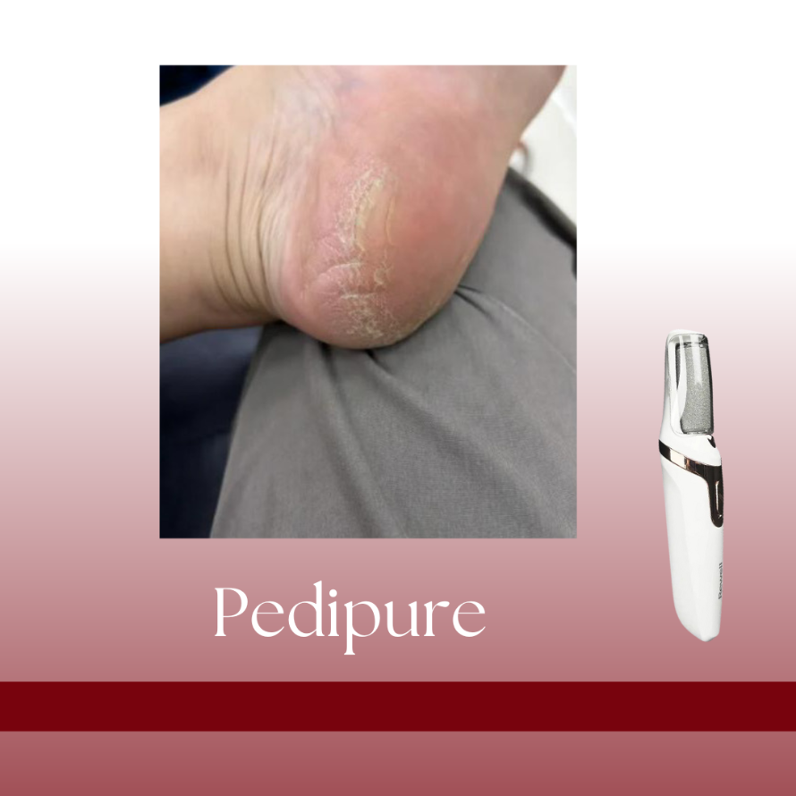 PEDIPURE - Kit Esfoliante Elettrico per pedicure