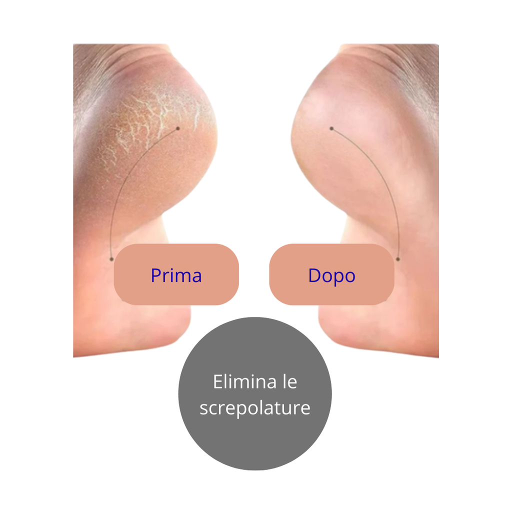 PEDIPURE - Kit Esfoliante Elettrico per pedicure
